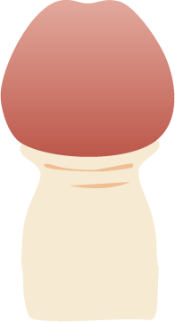 カントン包茎のイラスト