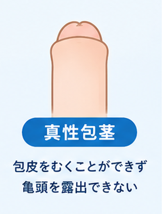 真性包茎